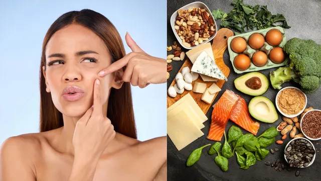 5-foods-that-you-must-include-in-your-diet-to-avoid-skin-breakouts-know-from-expert